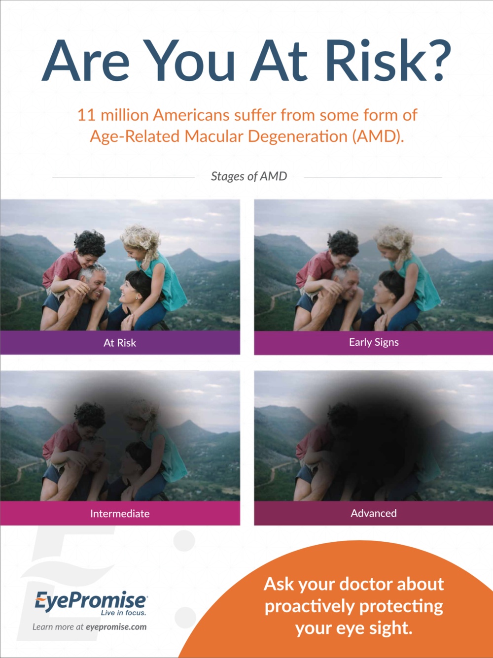 advanced macular degeneration infographic
